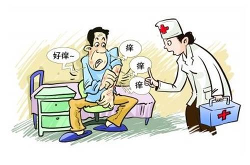 早期的牛皮癣有哪些症状