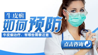 预防牛皮癣的小常识有哪些